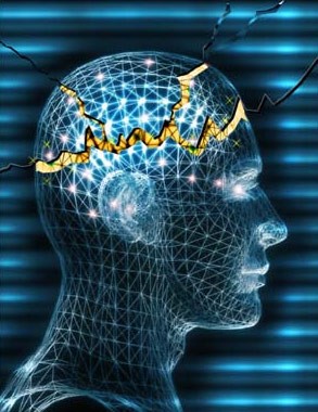 epilepsy