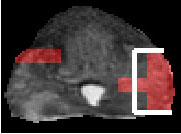 prostate image d