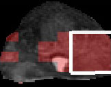 prostate image c