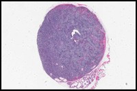 Prostate2