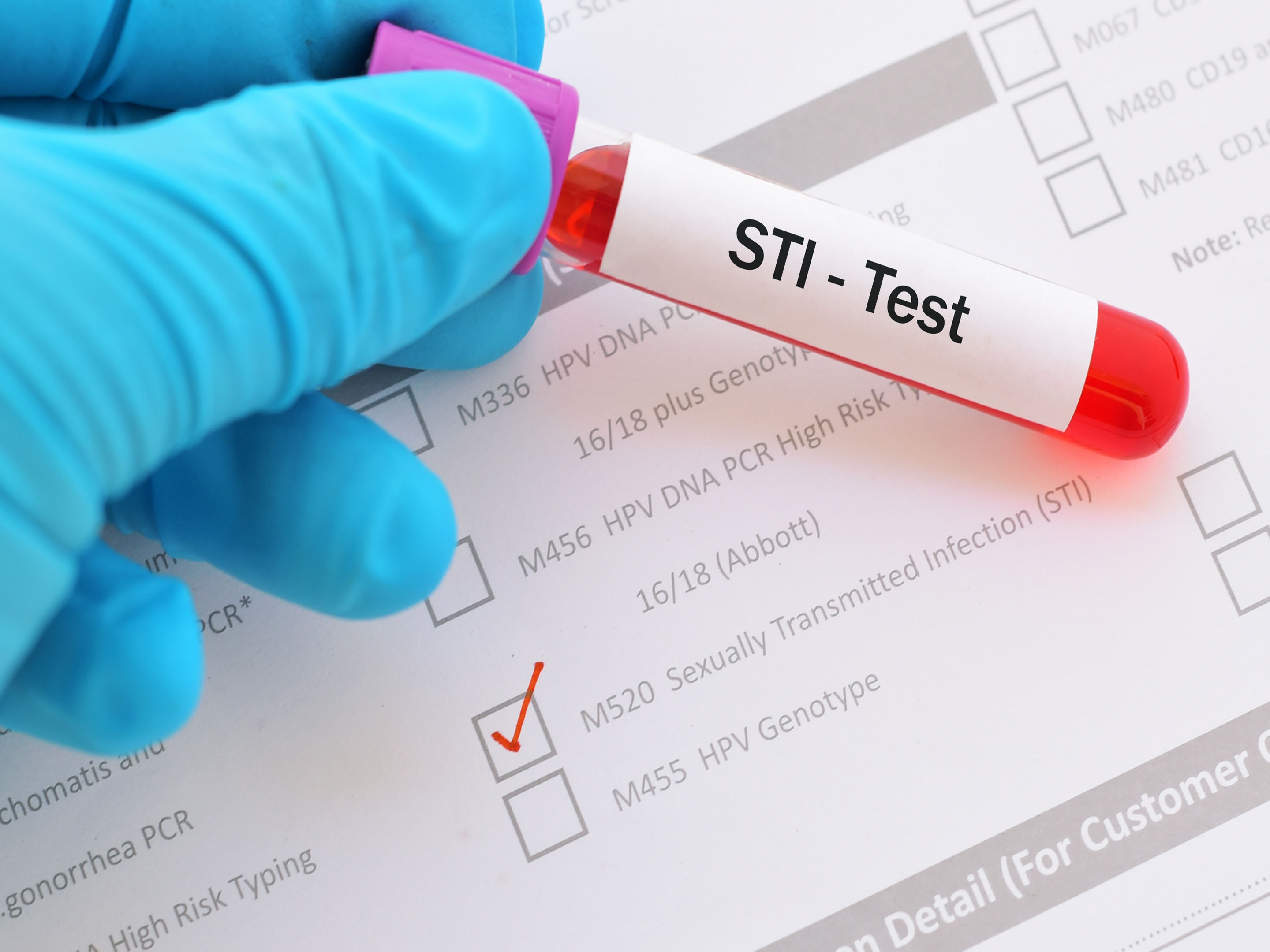 Testing u. Тест на ЗППП. STI Test что это.
