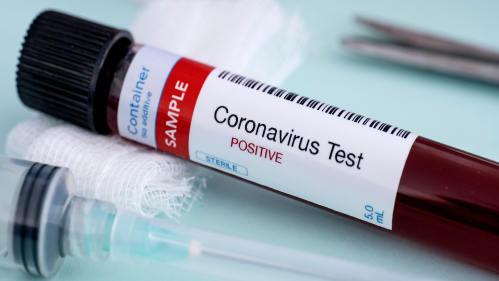 Coronavirus test