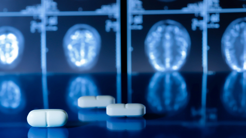 pills on a table in front of images of a brain MRI