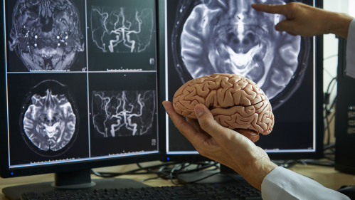 hand holds brain in front of brain scans