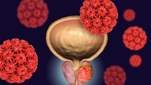 prostate cancer cells