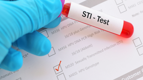 gloved hand hold blood sample