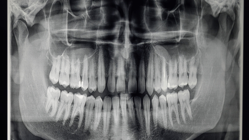 dental xray