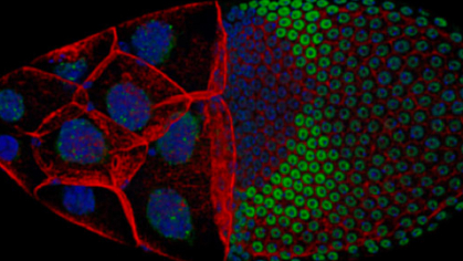 Tissue development