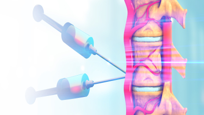 Rutgers researchers are harnessing AI and robotics to deliver new hope for spinal cord injury patients, successfully stabilizing an enzyme able to degrade scar tissue resulting from spinal cord injuries and promote tissue regeneration. The study, recently published in Advanced Healthcare Materials, details the team’s ground-breaking stabilization of the enzyme Chondroitinase ABC, (ChABC.) 