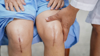 Patient with two knee replacements