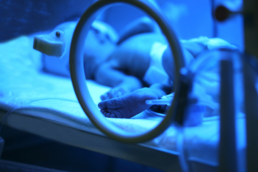 Image of underweight baby in NICU