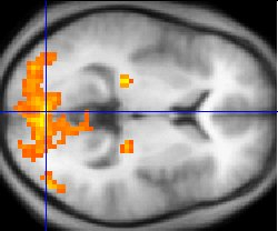 fMRI