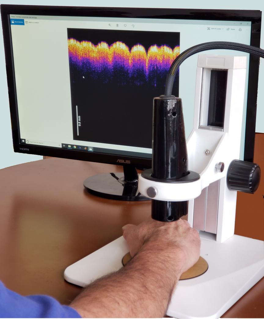 The virtual biopsy prototype device can distinguish between healthy skin and different types of skin lesions and carcinomas.