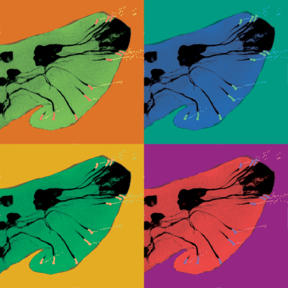 Caenorhabditis elegans