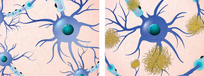 Illustration of brain cells