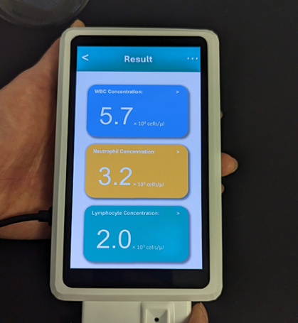 A person's hand holding a smartphone-sized device indicating with three boxes on the screen showing levels of white blood cells