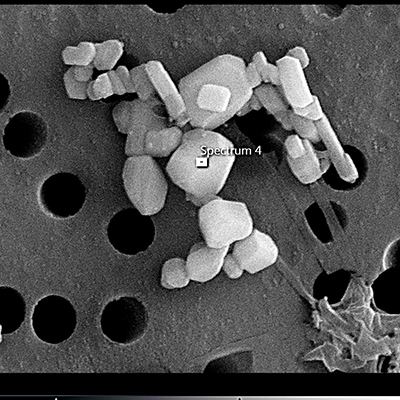 images from a microscope showing clumbs of white pebble-like objects against a grey background