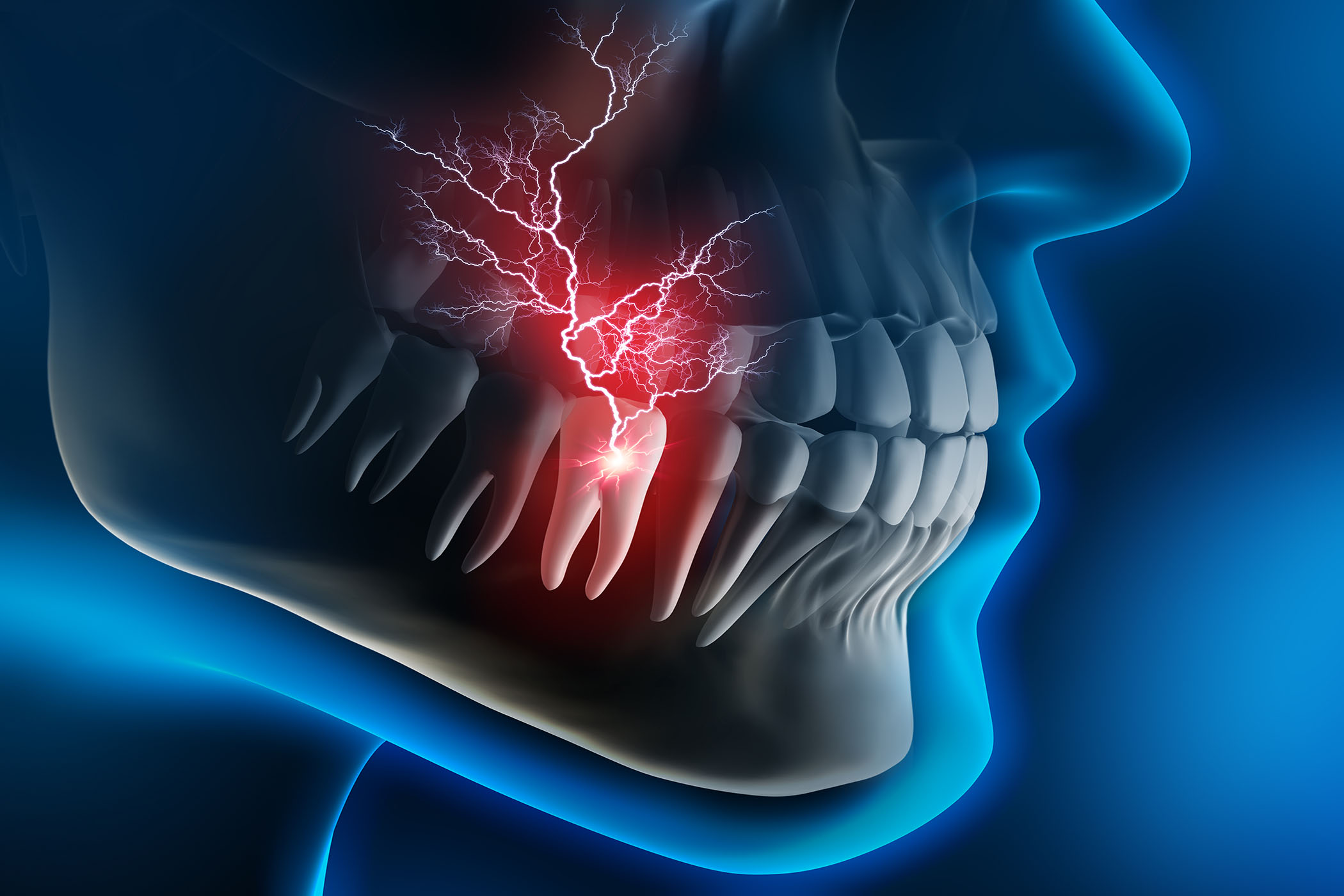 Marijuana Component Offers Opioid Alternative by Effectively Treating Dental  Pain